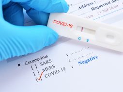 negativan-PCR-test