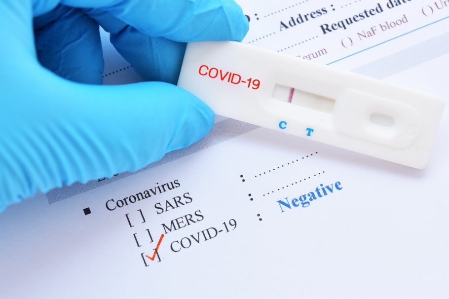 negativan-PCR-test