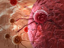 rak-karcinom-celije