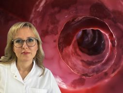 Prof.dr Tamara Milovanović, ulcerozni kolitis