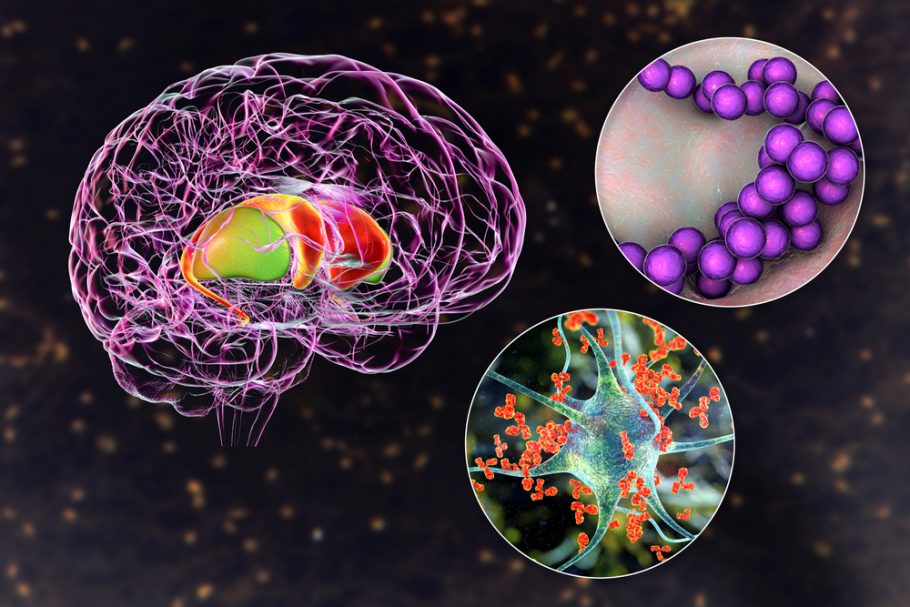 Turetov sindrom, tikovi, neurološki sistem