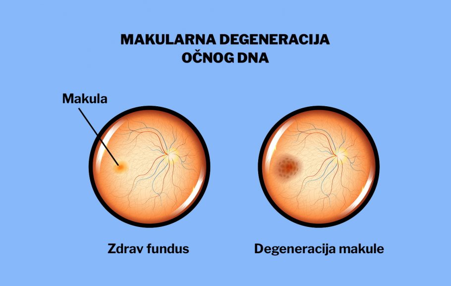 makula-žuta mrlja-očno dno