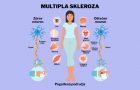 multipla skleroza-depresija- umor-gubitak posla
