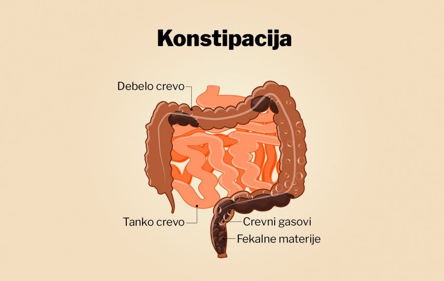 konstipacija-pražnjenje creva-putovanja-poremećaj