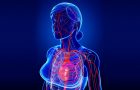 srce- srčane bolesti kod žena- kardivaskularne bolesti