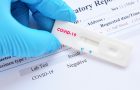 pcr test- covid test - korona virus-zdravstvena propusnica