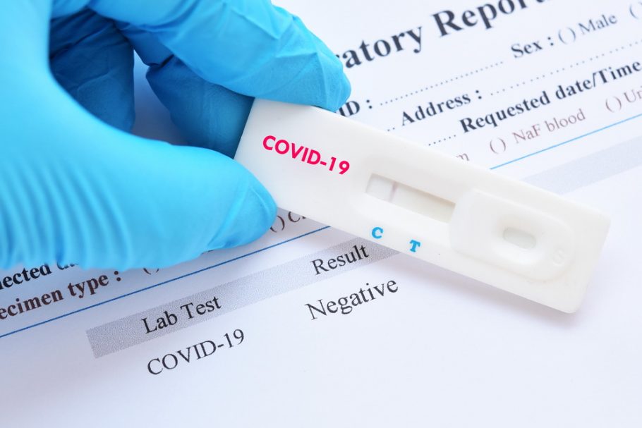 pcr test- covid test - korona virus-zdravstvena propusnica