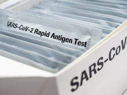 brzi antigenski test - ovlašćene laboratorije- mikrobiloške laboratorije