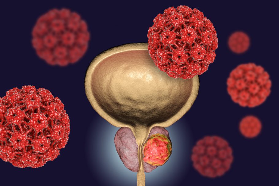 Karcinom prostate, ejakulacija