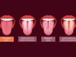 jezik- boja jezika- otkriva bolesti
