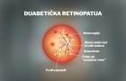 dijabetička retinopatija- slepilo- vid