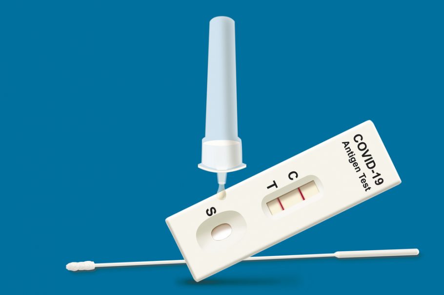 antigen test