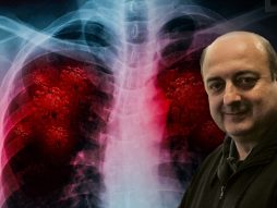 Omikron soj, pneumonija