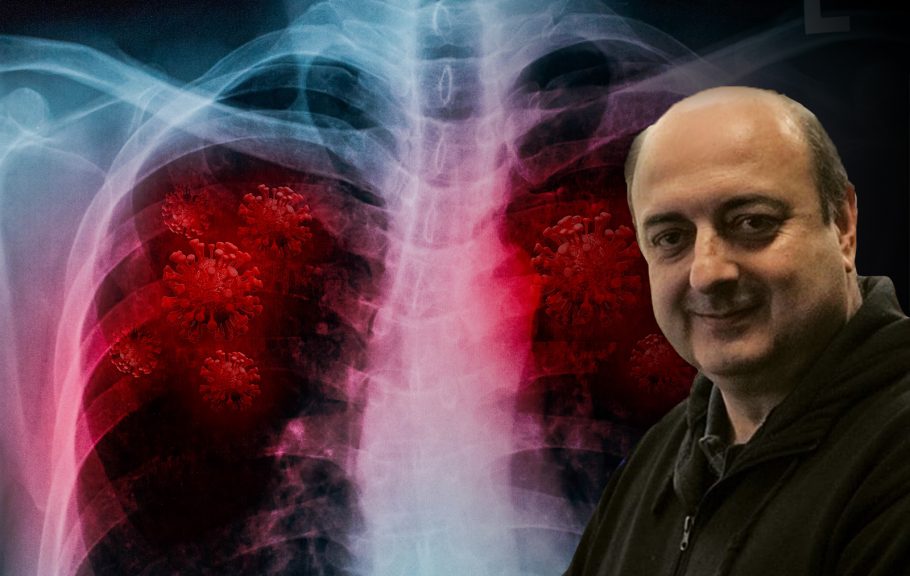 Omikron soj, pneumonija