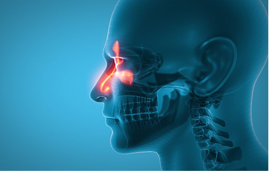 rak nosa i sinusa