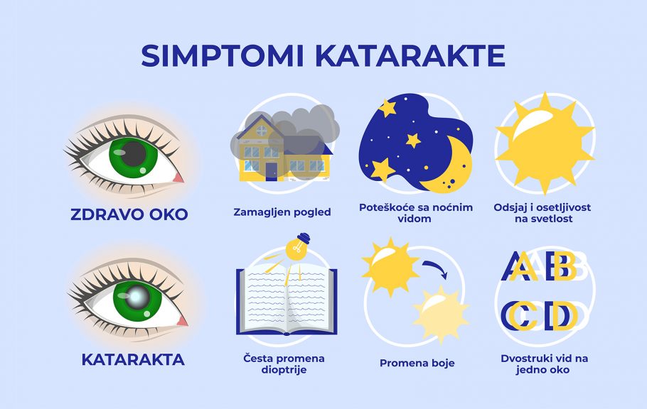 Simptomi katarakte