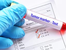 tumor markeri