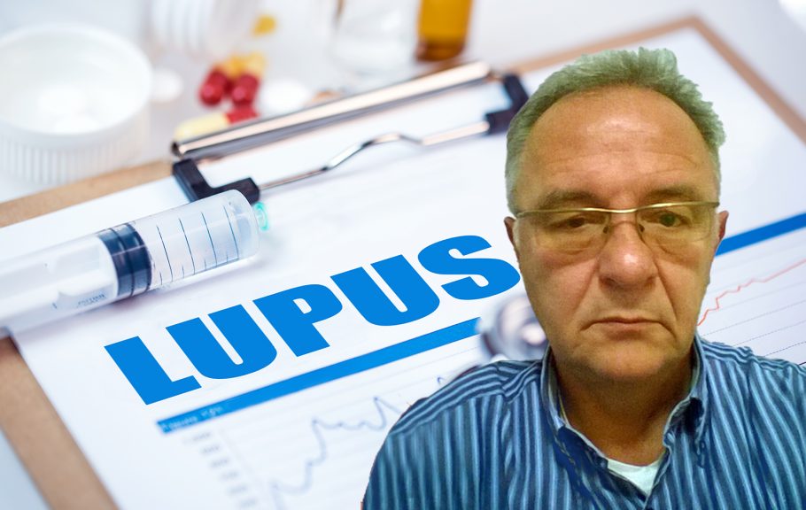 lupus