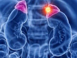 Tumor nadbubrežne žlezde
