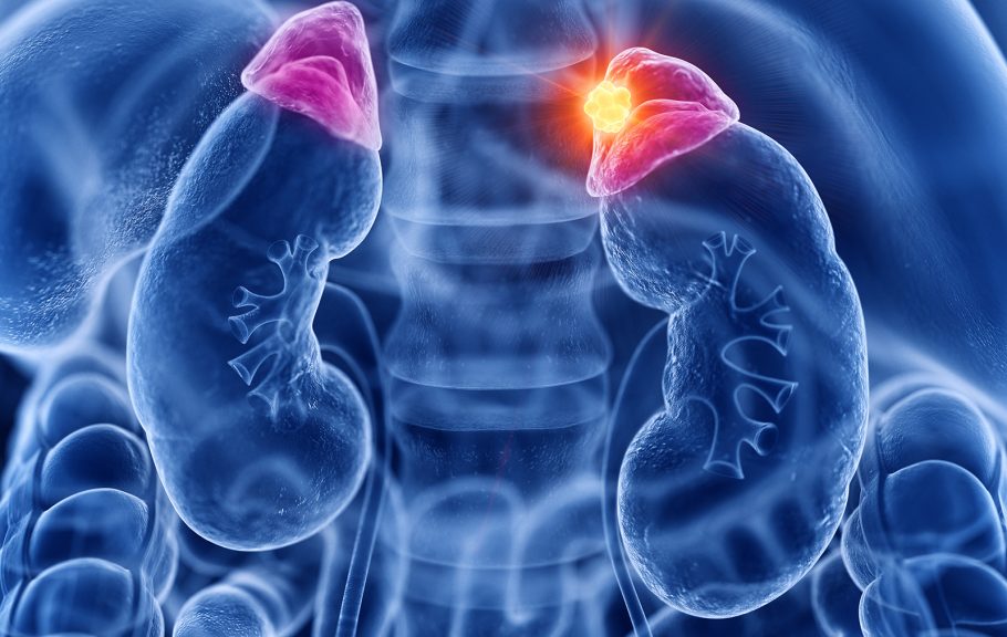 Tumor nadbubrežne žlezde