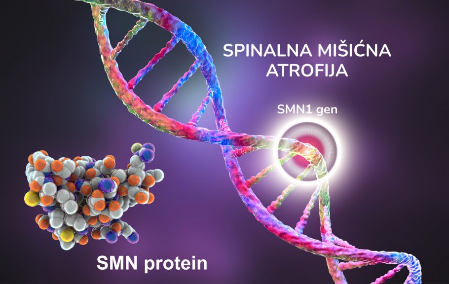 spinalna mišićna atrofija
