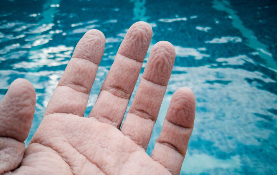 smežurani prsti od vode